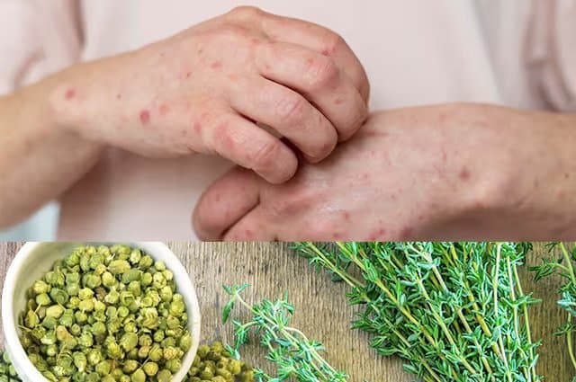 Oregano Allergy Symptoms